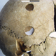 Penetrating wounds found on the skull of a young adult female.